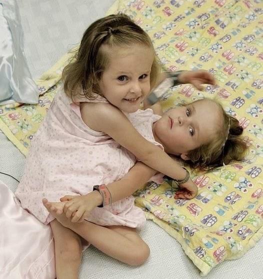 “Unbelievable story❗️❗️ These girls were born as siamese twins, but were successfully separated at the age of four in 2006.Now they are already 18.The sisters live independent lives, attend school, like drawing, and inspire others through social media. Have a look at the photos of the girls in the comments below”